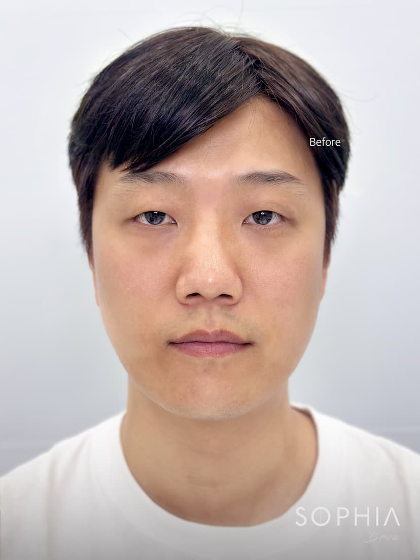 비대칭으로 고민하던 눈썹 - Before