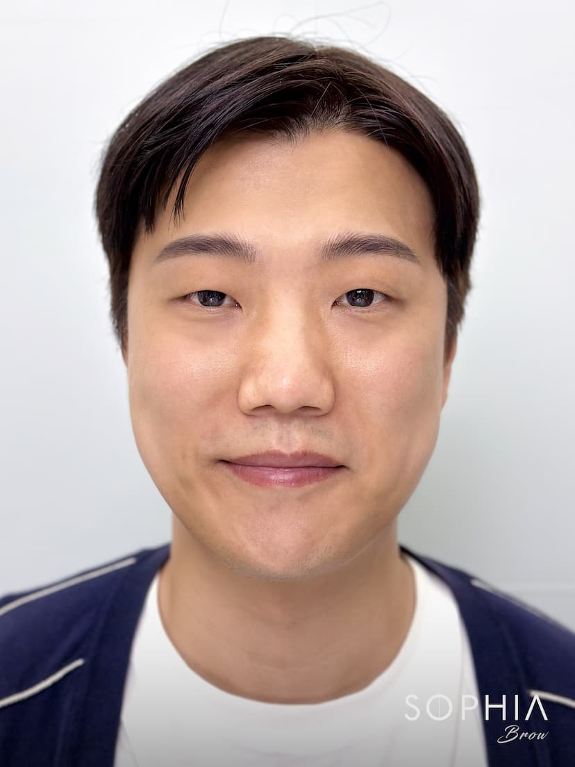 비대칭으로 고민하던 눈썹 - After