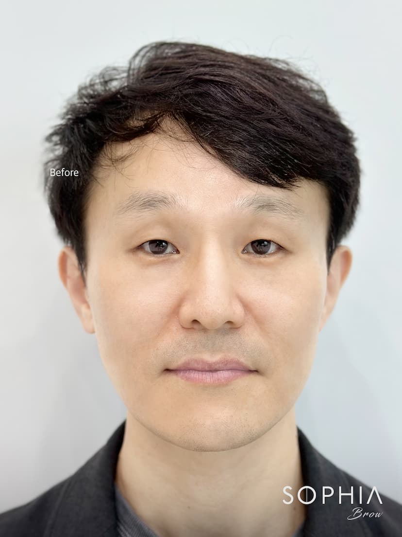 흐릿했던 이미지가 또렷해졌어요 - Before