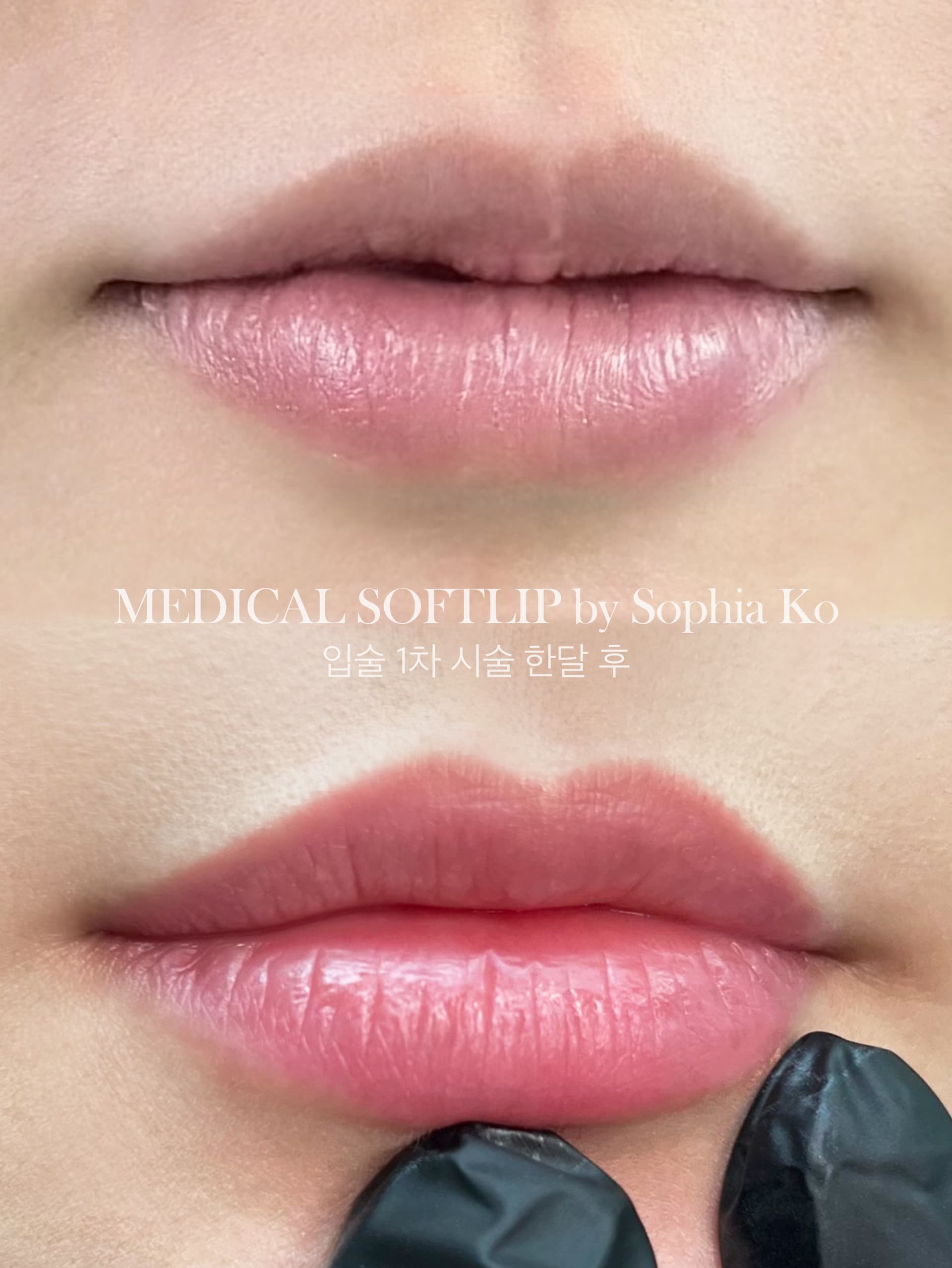 볼륨있는 입술로