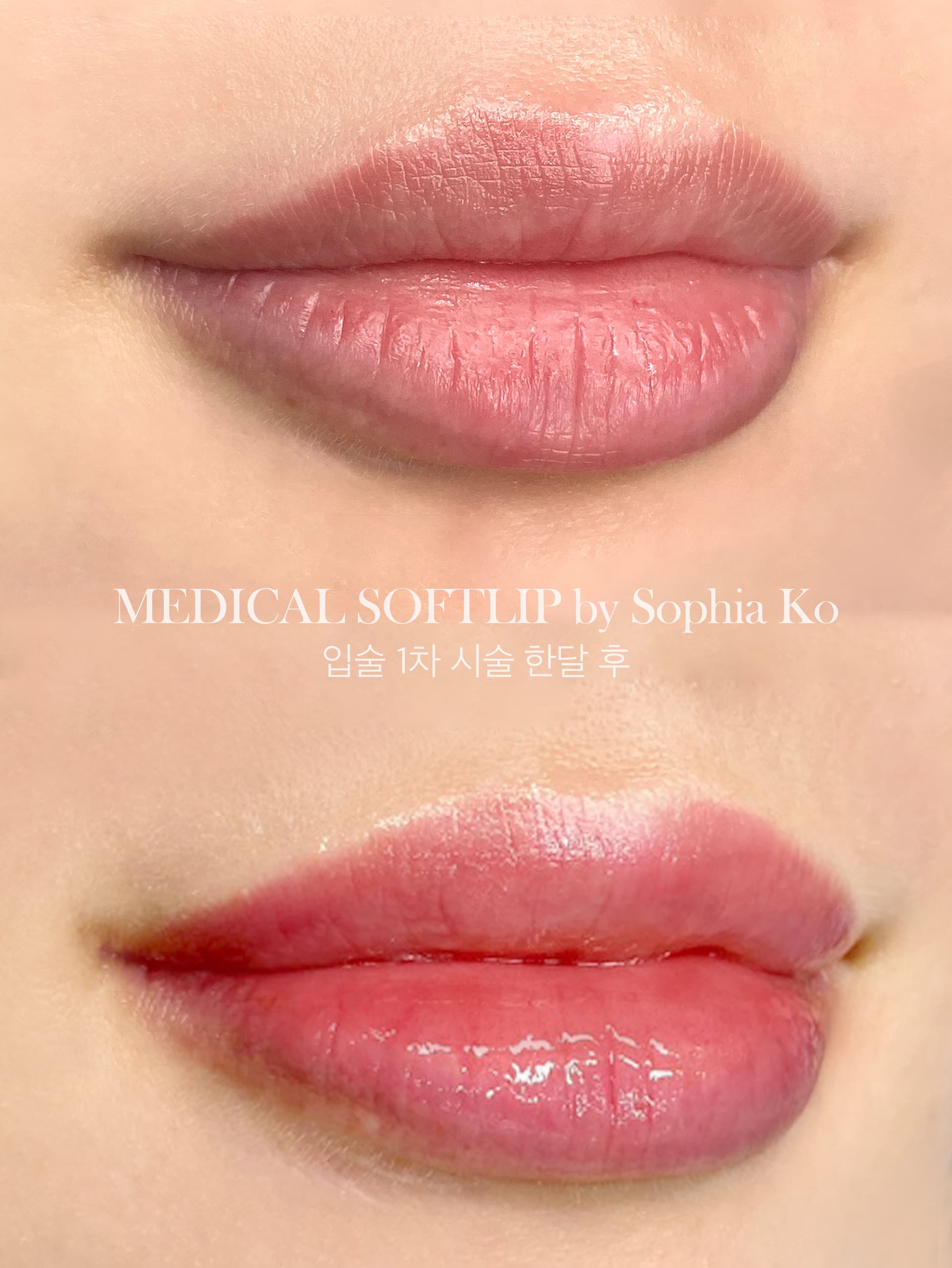 입술 색상 보정