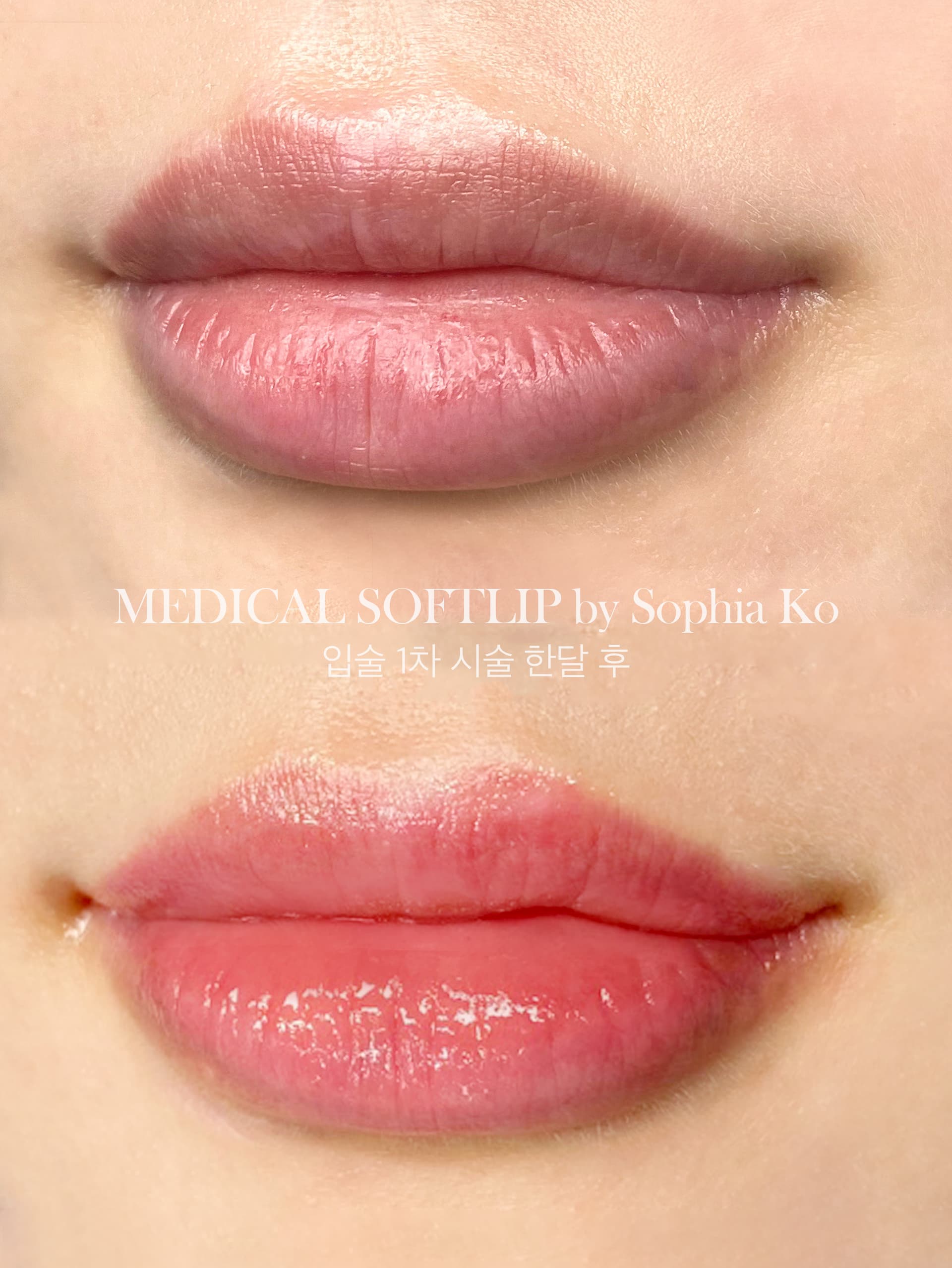 어둡고 탁해보인 입술이