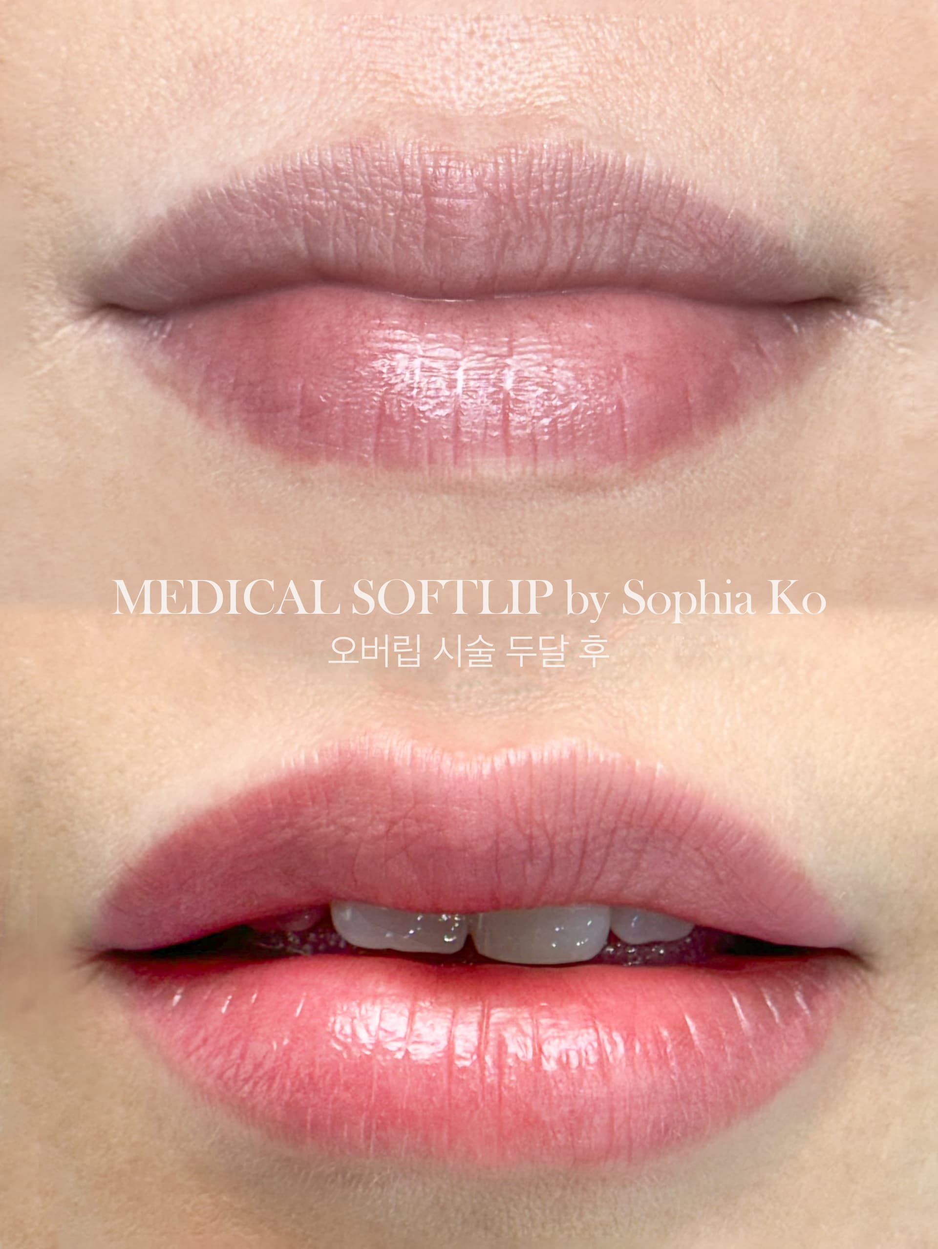 자연스러운 컬러로