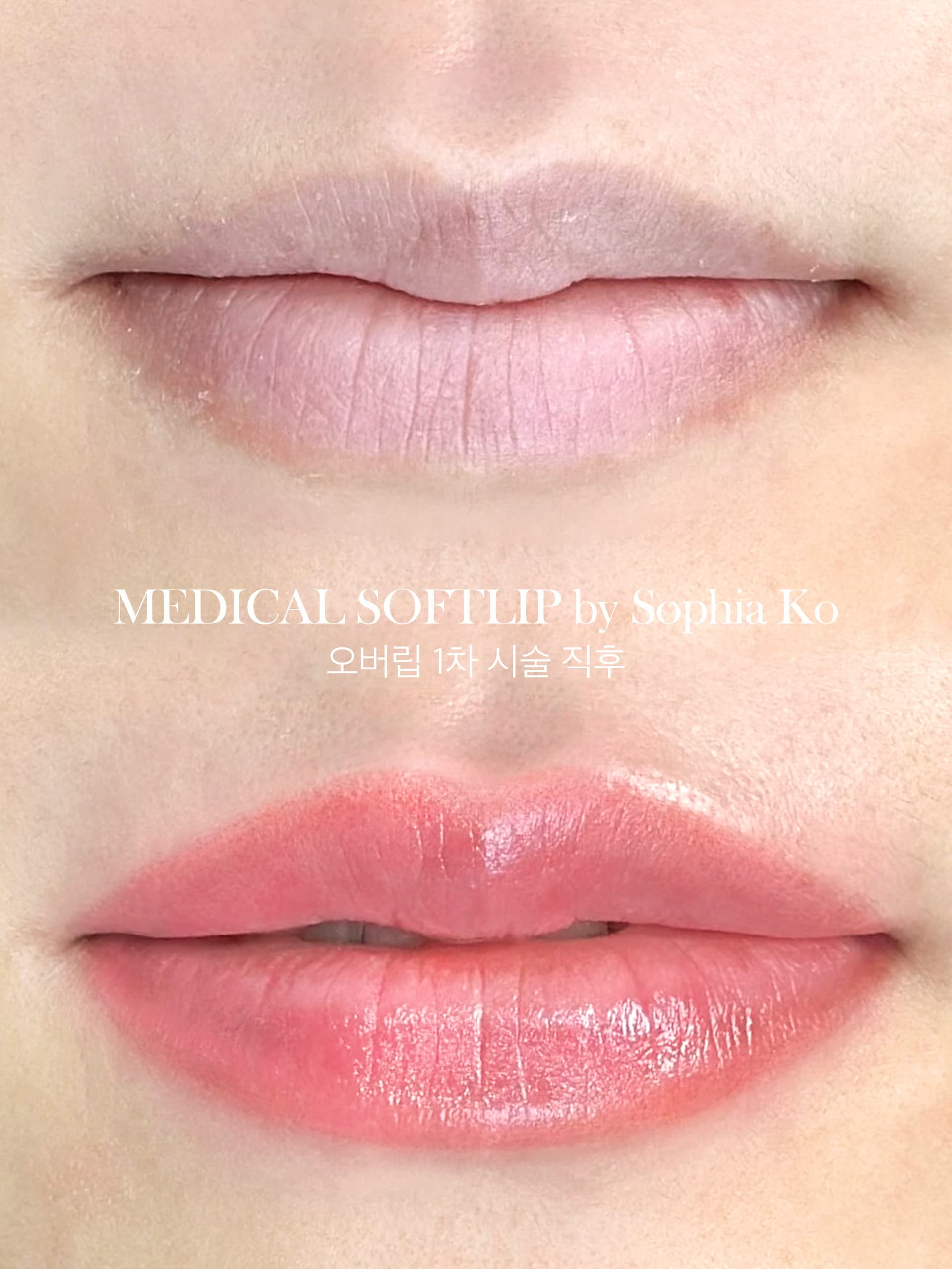 선명하지만 자연스럽게