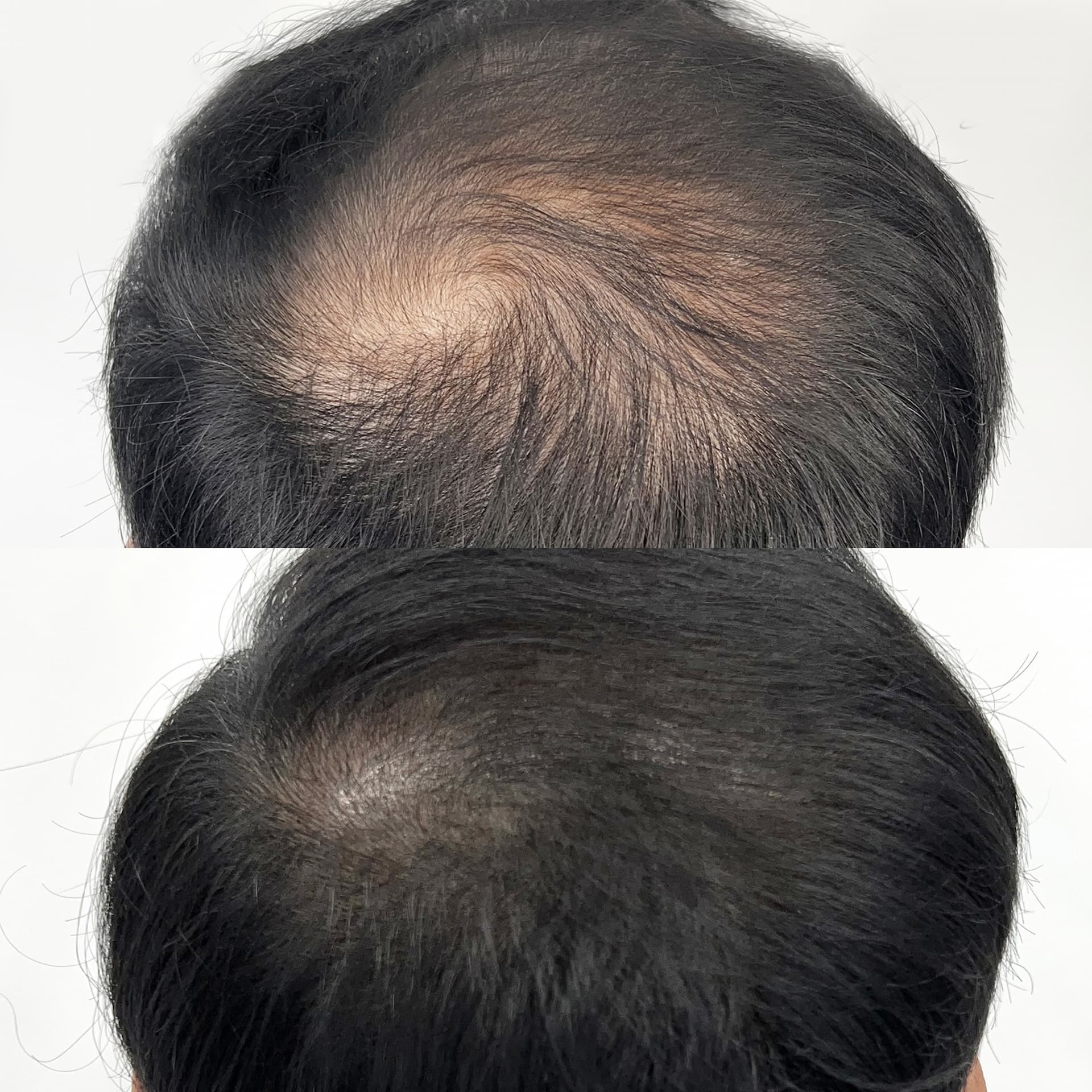 빈 공간만 자연스럽게