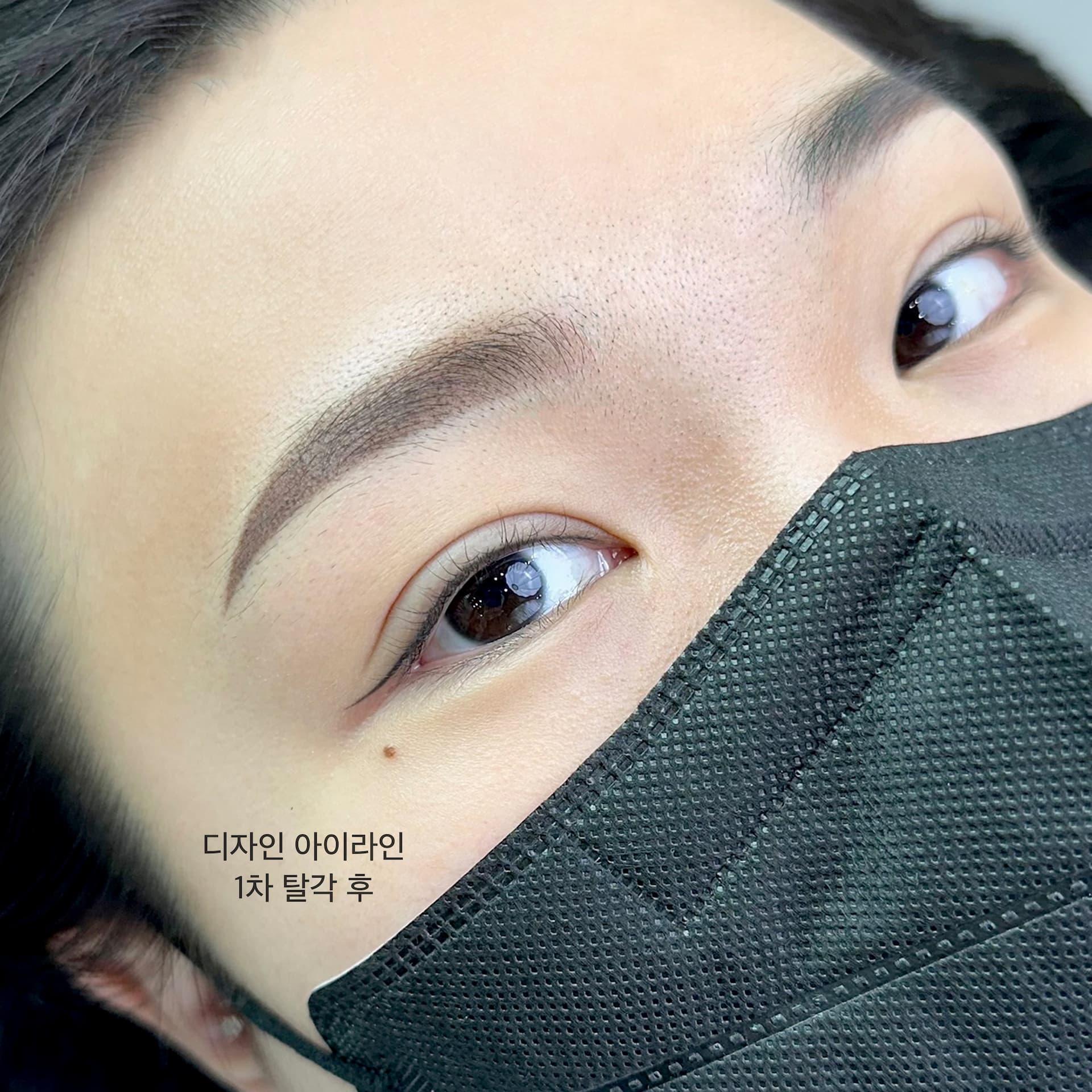 이식하지 않아도